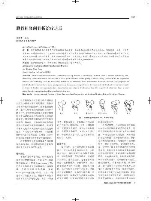 股骨粗隆间骨折治疗进展