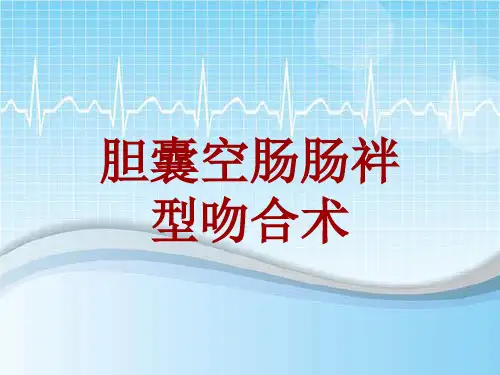 手术讲解模板：胆囊空肠肠袢型吻合术