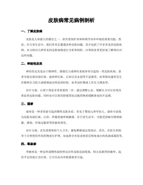 皮肤病常见病例剖析