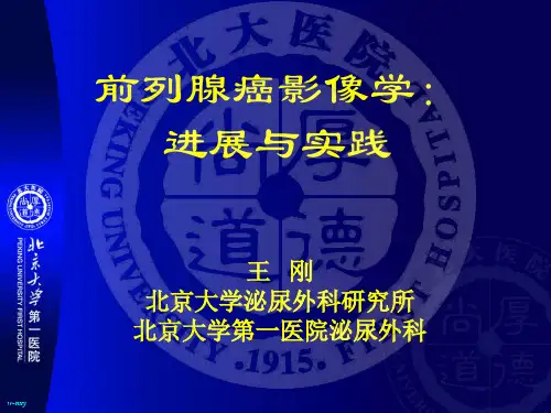 前列腺癌影像学