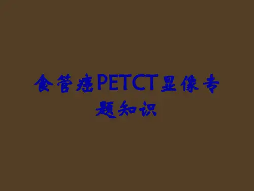 食管癌PETCT显像专题知识
