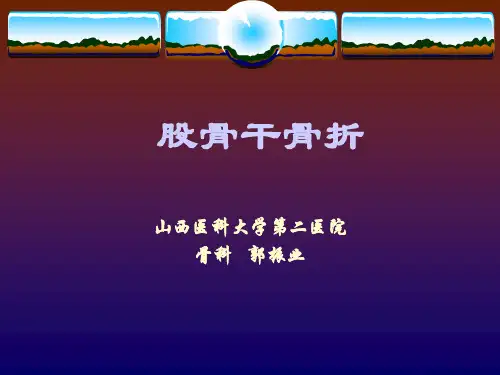 股骨干骨折-郭振业