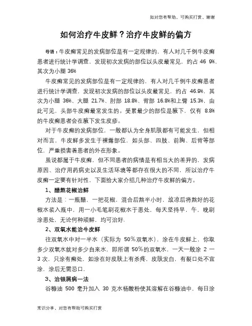 如何治疗牛皮鲜？治疗牛皮鲜的偏方