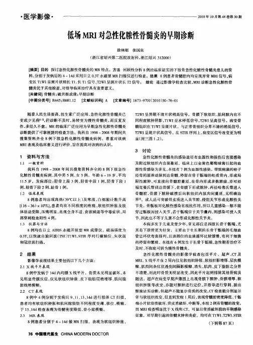 低场MRI对急性化脓性骨髓炎的早期诊断