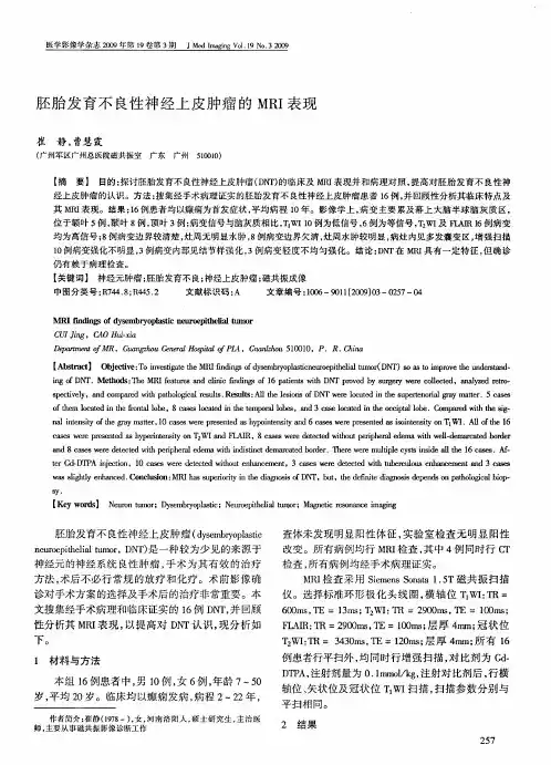 胚胎发育不良性神经上皮肿瘤的MRI表现