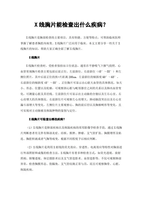 X线胸片能检查出什么疾病？
