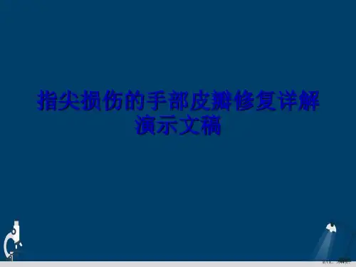 指尖损伤的手部皮瓣修复详解演示文稿