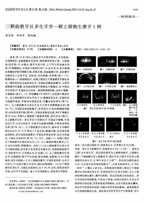 三颗前磨牙区多生牙并一颗上颌侧生磨牙1例