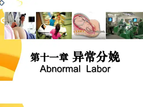 十一异常分娩产力异常精品PPT课件