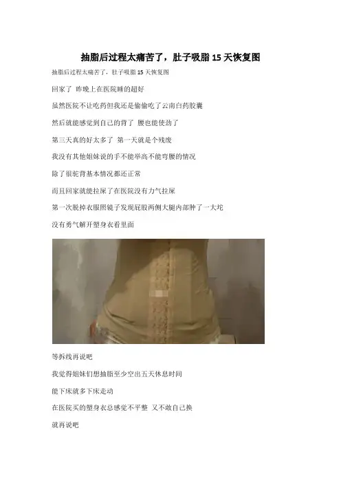 抽脂后过程太痛苦了,肚子吸脂15天恢复图