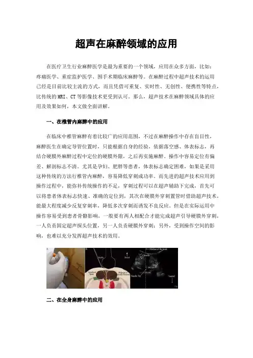 超声在麻醉领域的应用
