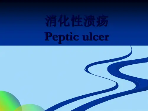 消化性溃疡(共72张PPT)