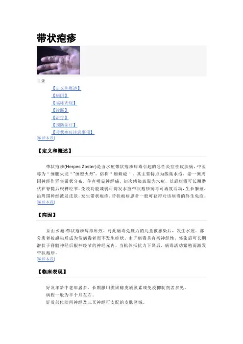带状疱疹