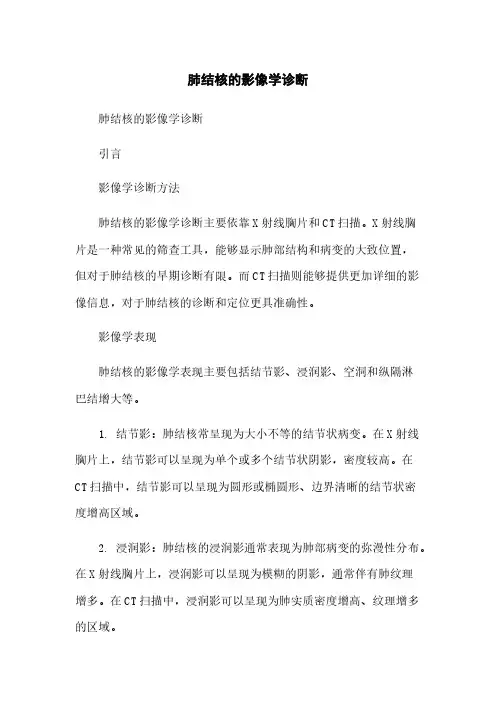 肺结核的影像学诊断
