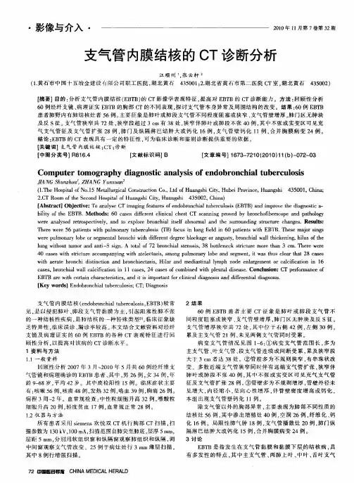 支气管内膜结核的CT诊断分析