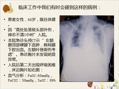 顽固性低氧血症的诊治PPT.