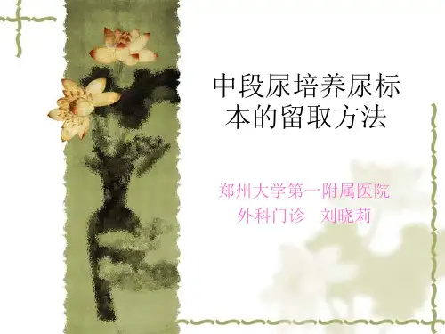 中段尿培养尿标本的培养方法