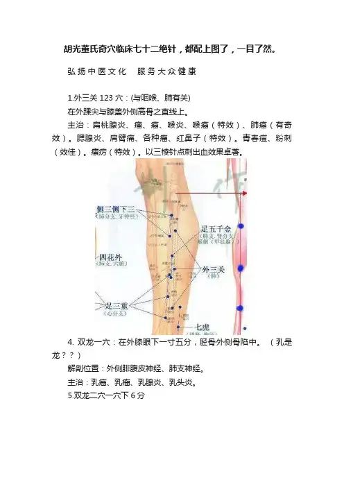 胡光董氏奇穴临床七十二绝针，都配上图了，一目了然。