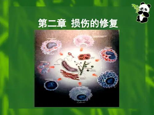 病理学 第二章 损伤的修复