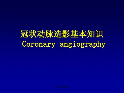 冠状动脉造影基本知识