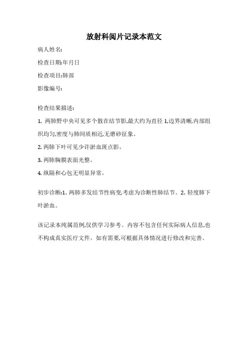 放射科阅片记录本范文