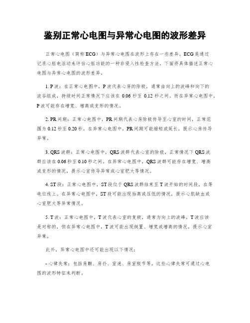 鉴别正常心电图与异常心电图的波形差异