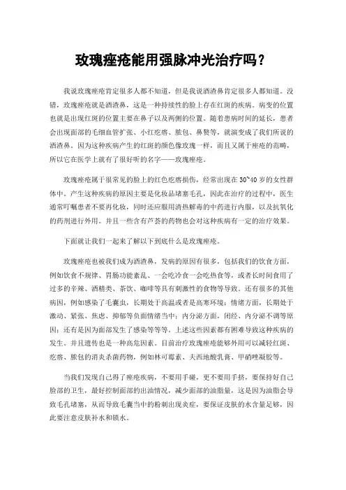 玫瑰痤疮能用强脉冲光治疗吗？