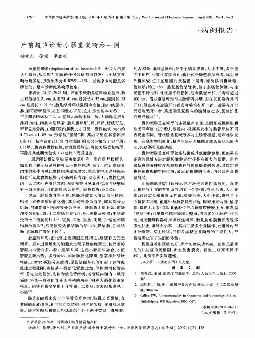 产前超声诊断小肠重复畸形一例