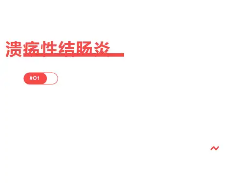 溃疡性结肠炎的治疗
