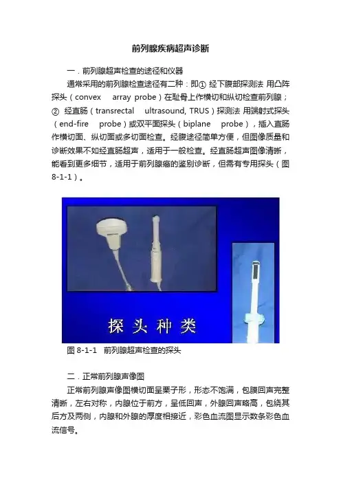 前列腺疾病超声诊断