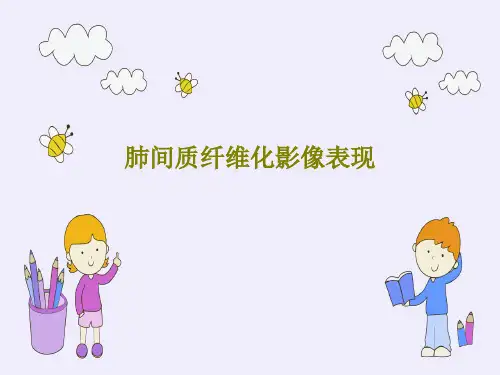 肺间质纤维化影像表现共49页