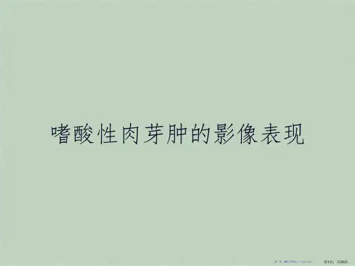 嗜酸性肉芽肿的影像表现