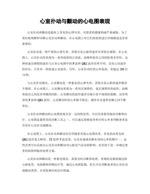 心室扑动与颤动的心电图表现