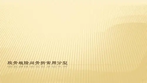 股骨粗隆间分型ppt课件