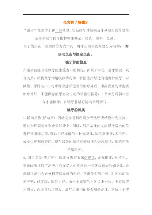 全方位了解镶牙