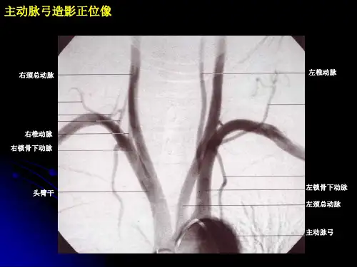 介入治疗解剖学图谱神经血管课件