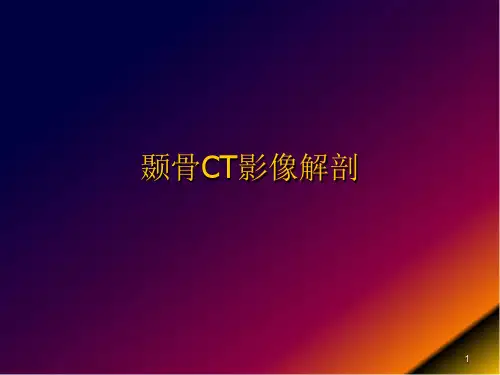 (医学课件)颞骨影像解剖PPT幻灯片