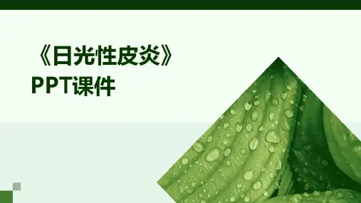 《日光性皮炎》课件