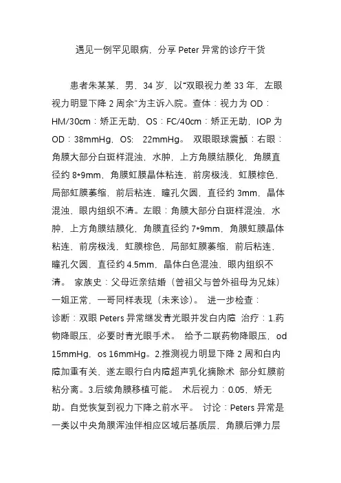 遇见一例罕见眼病,分享Peter异常的诊疗干货