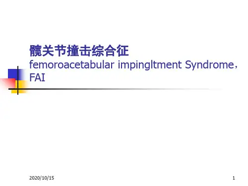 髋关节撞击综合征的影像学诊断 ppt课件