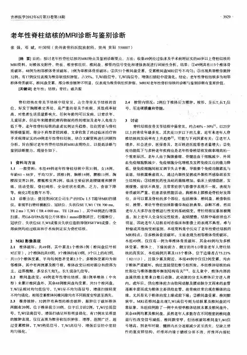 老年性脊柱结核的MRI诊断与鉴别诊断