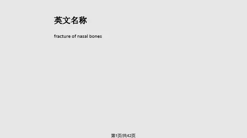 鼻骨骨折详解PPT课件