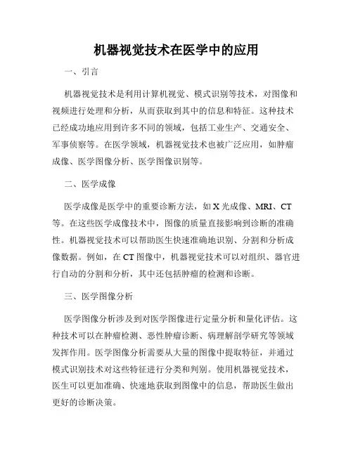 机器视觉技术在医学中的应用