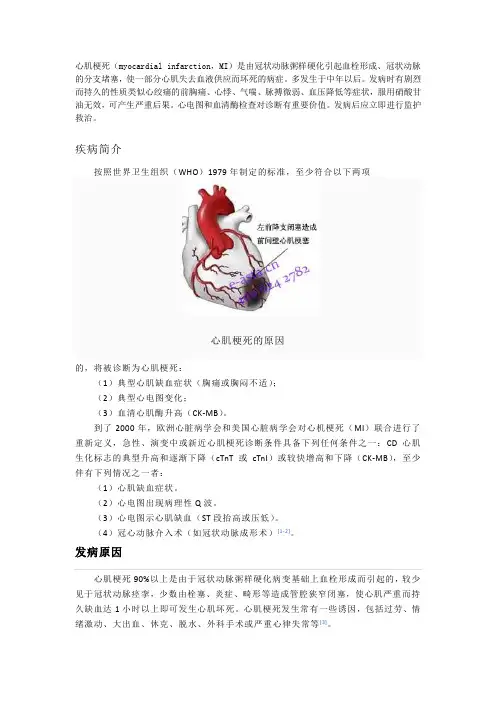 心肌梗死