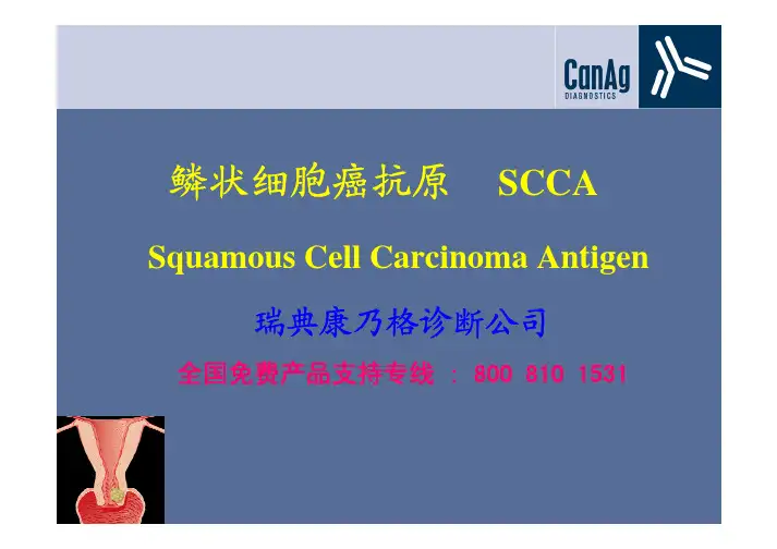 鳞状细胞癌抗原SCCA