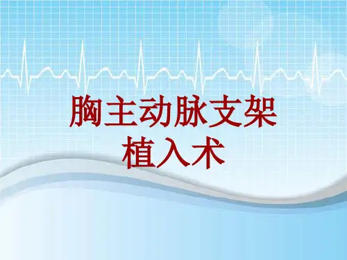 手术讲解模板：胸主动脉支架植入术