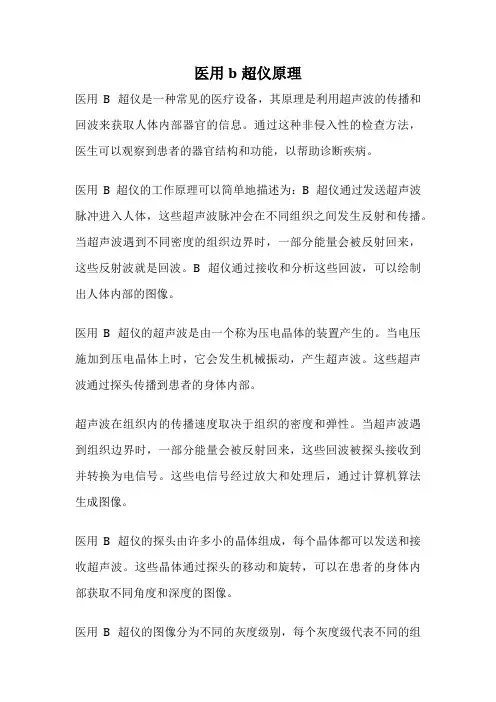 医用b超仪原理