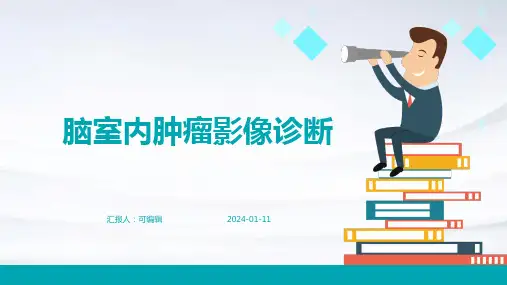脑室内肿瘤影像诊断