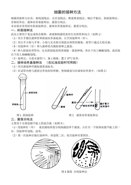 细菌的接种方法