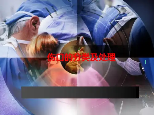 伤口的分类及处理 ppt课件